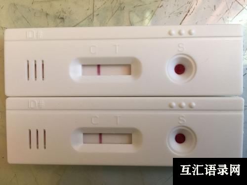 如何判断自己得了艾滋病？一分钟教你检查方法