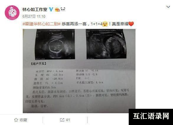 霍建华宣布二胎是真的吗（林心如霍建华二胎出生,是男孩还是女孩）